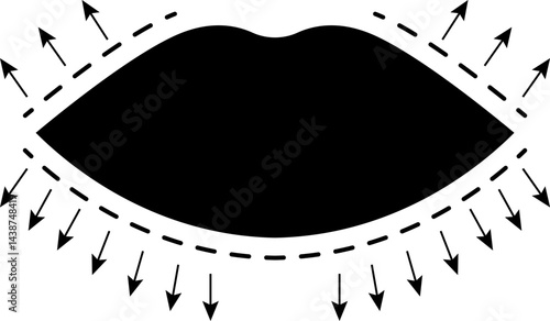 Lip lifting icons. Lips lifting vectors contouring. Lips shape correction - Before and after lip augmentation graphics.