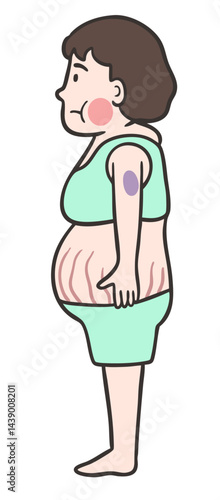 クッシング症候群の女性の側面