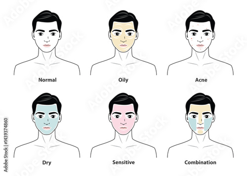 The man with skin types vector set isolated on white background. Different basic types of skin, normal, oily, acne prone, dry, sensitive and combination skin. Men skin care concept illustration.