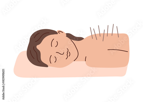 Acupuncture, woman patient with inserted acupuncture needles. Alternative medicine. Body therapy and spa, wellness and acupressure. Vector illustration