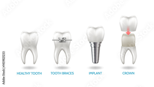 realism-set-teeth-different-types-dental-problems