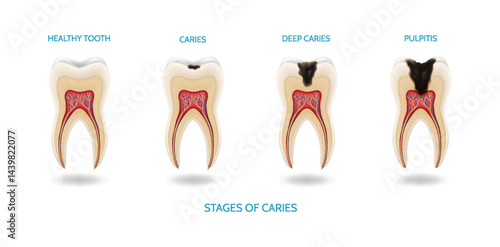 realism-set-teeth-different-types-dental-problems