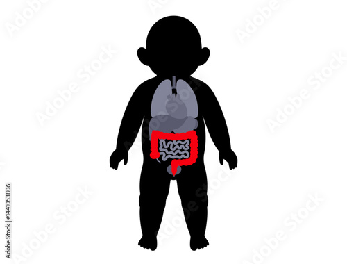 Intestines diseases in a child
