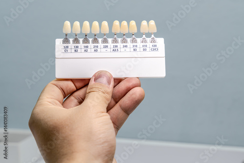 Organized dental shade guides with alphanumeric labels displaying various tooth colors for precise restorations and treatment planning