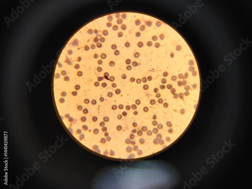 bacteria and microbes under a microscope