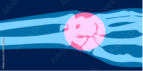 X-ray image of hand pain ilustration. 2D Picture rontgen of Hand bone in painful injury damage. Vector illustration