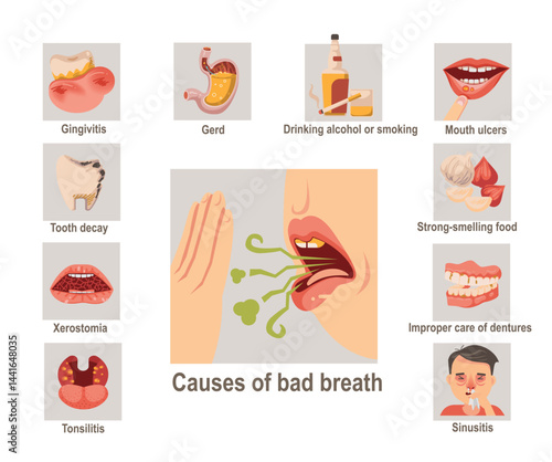 Causes of bad breath