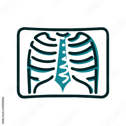 X-ray image of a human ribcage showcasing detailed bone structure