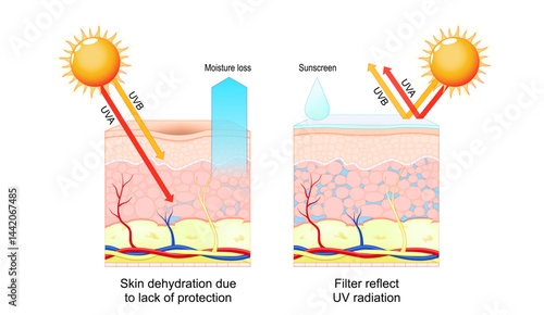Skin protection. Sunscreen, UV radiation and SPF