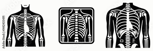 The X ray. Hospital Healthcare Clinic Treatment Symbol. roentgenogram medical imaging technique using electromagnetic radiation for insight.