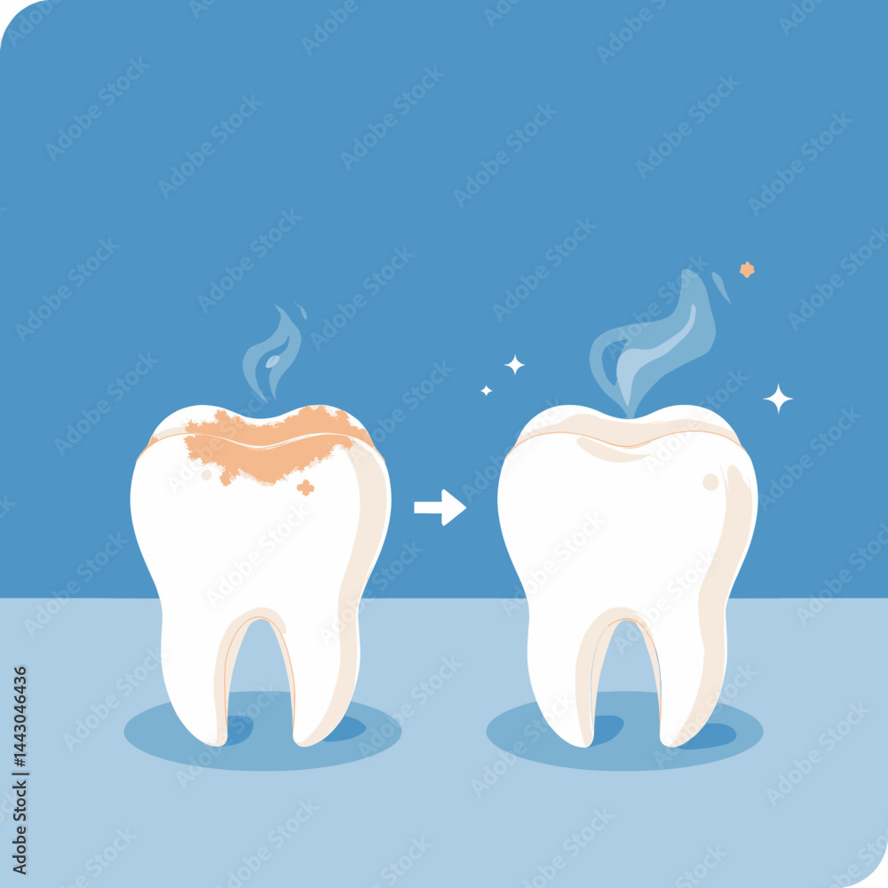 Cartoon tooth cleaning process with arrow on blue