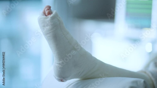 Girl with broken leg in hospital room, bandaged foot close up