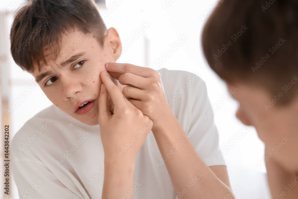 Teenage boy with acne squishing pimples near mirror in bathroom, closeup Teenage boy with acne squishing pimples near mirror in bathroom, closeup