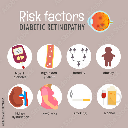Vector medical poster risk factors diabetic retinopathy. Eye diseases concept.
