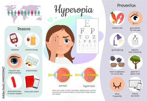 Vector medical infographics hyperopia. Causes and prevention of eye diseases.
