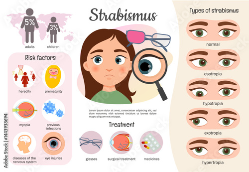 Vector medical infographics strabismus. Eye disease poster. Causes, types of strabismus.
