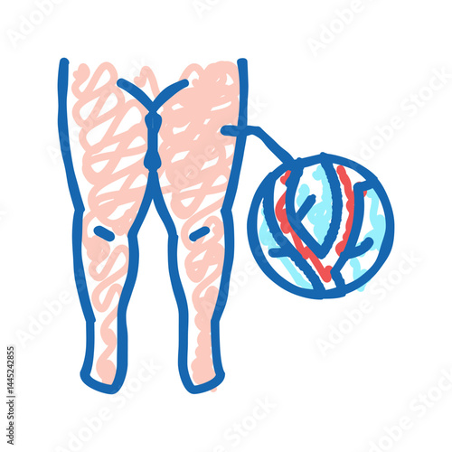lymphatic edema icon doodle illustration
