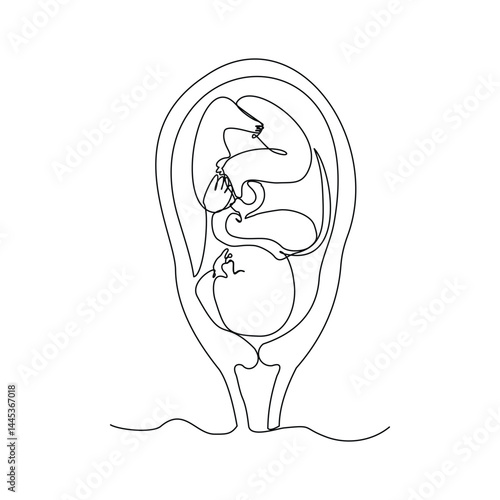 Continuous single line of baby fetus in mother womb. Human embryo with umbilical cord sketch drawing editable stroke vector illustration
