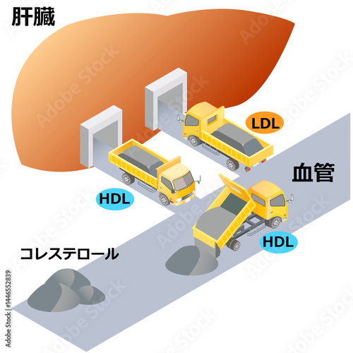 悪玉コレステロールと善玉コレステロール