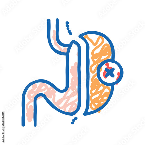 sleeve resection bariatric icon doodle illustration