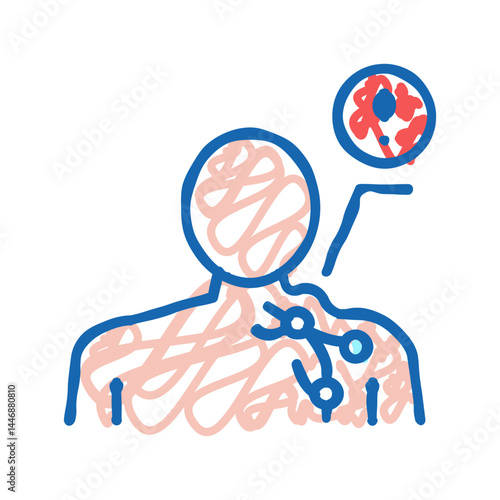 lymphoma disease icon doodle illustration