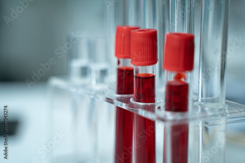 Laboratory research with blood sample in tube being dripped for medical test using liquid medicine under analysis to study results and improve scientific understanding