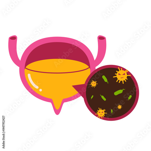 Bladder disease. Urinary tract infection illustration