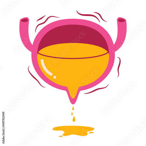 Bladder disease. Urinary incontinence illustration 