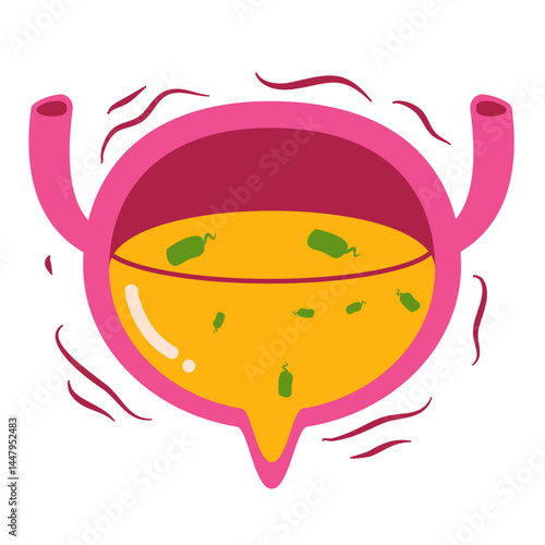 Bladder disease. Urinary tract infection illustration