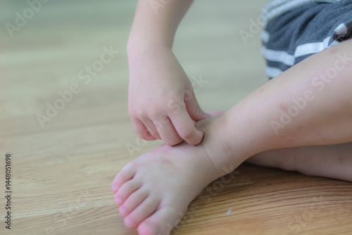 Child with swelling spot due to mosquitoes bite on leg. Health care concept. Copy space. Selective focus. Blue background. 