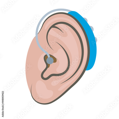 Ear with hearing aid icon in flat style on a white background. Deaf and hear aid concept. Hearing aid device in outline human ear silhouette isolated on white. Design element for medicine, health care