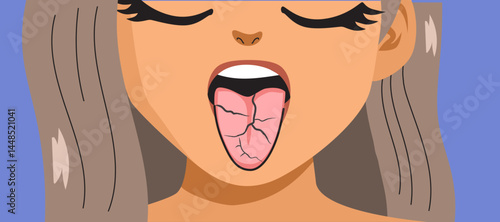 Cartoon close-up of a woman showing a fissured tongue vector illustration. Drawing for health, anatomy and wellness designs