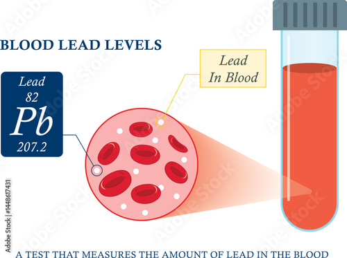 Heavy Metal Lead Iron toxic industry water air food based paint brain cancer kidney health human environmental contamination power plant risk danger fish Drink line test kids level lab poison waste