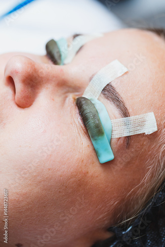 Eyelash lamination procedure on a woman's face. A cosmetologist glues long eyelashes with tweezers onto a woman's eye during an eyelash extension procedure.