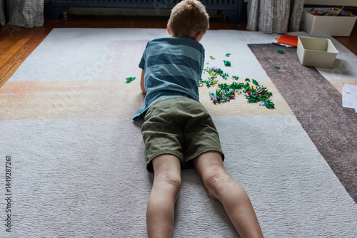Little boy with eczema lays on a rug