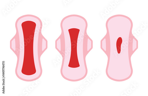 Vaginal Postpartum Bleeding Causes and Management