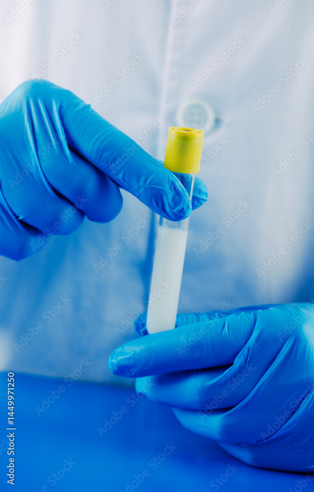 laboratory worker holding a test tube with semen