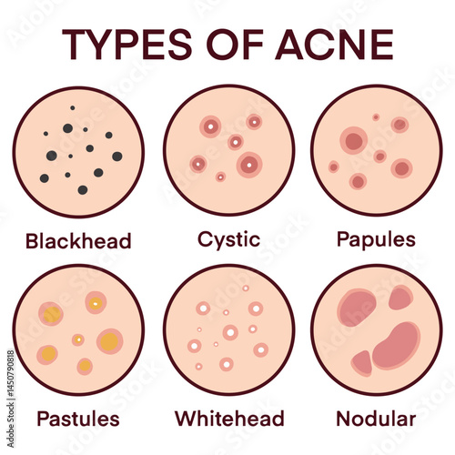 Medical infographic showing different types of skin rashes, helping identify dermatological conditions, symptoms and treatments, useful for doctors, students, dermatology education or healthcare guide