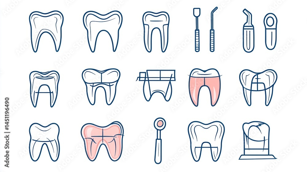 Dental Procedures Illustrations (23) Dental Procedures Illustrations (23)
