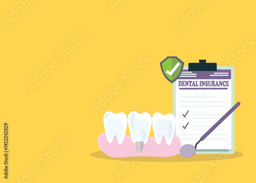 Vector drawing of tooth implant in between other teeth. 