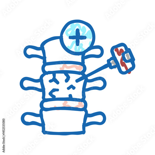 vertebroplasty and kyphoplasty icon doodle illustration