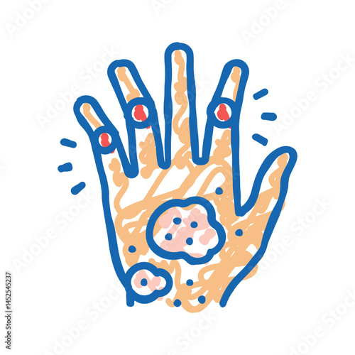 psoriatic arthritis skin health problem icon doodle illustration