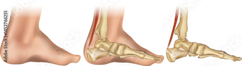 Human Foot Arch with Bone Anatomy. Medical Foot Illustration. Side View of Foot Arches Showing Skeletal Structure