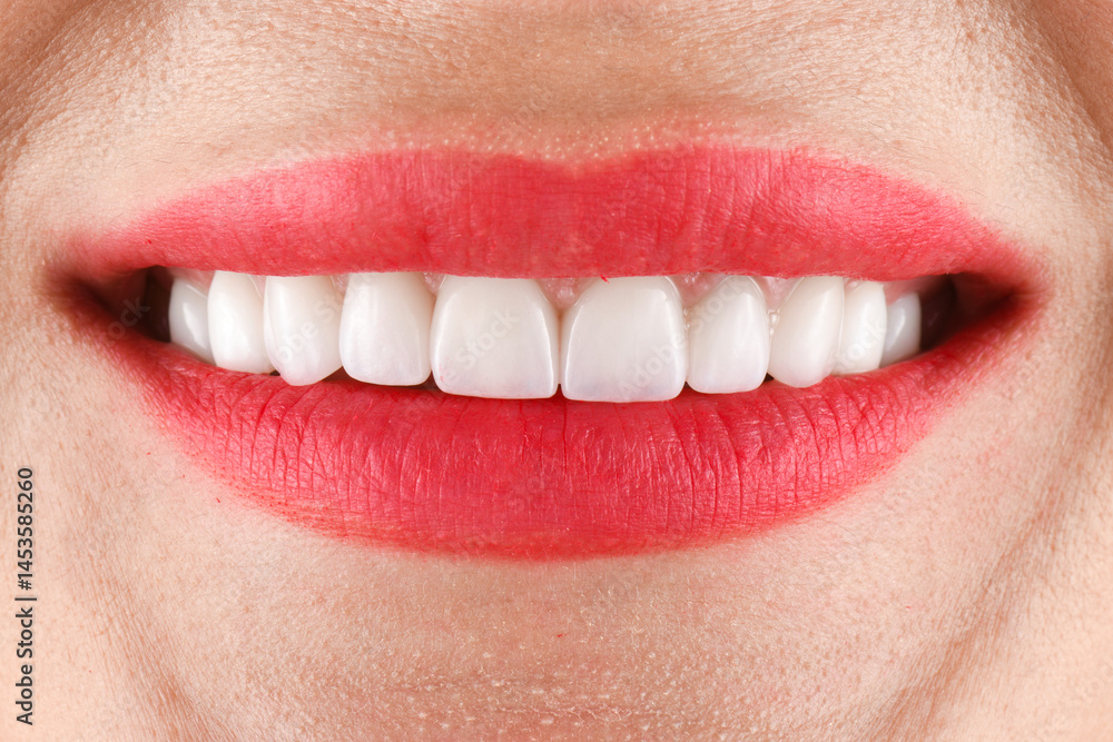 Fototapeta premium ceramic crowns and veneers