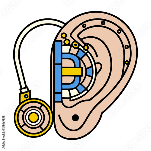 Bionic Ear with Improved Hearing Implant - Biohacking Prosthetics  