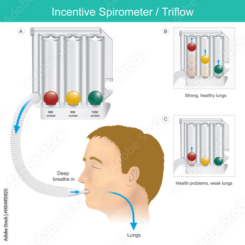 Incentive Spirometer.  Triflow Lung Exercise Device Illustration