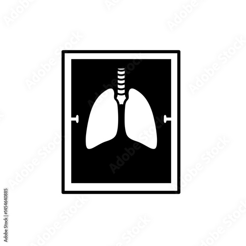 lungs Chest Fluoroscopy