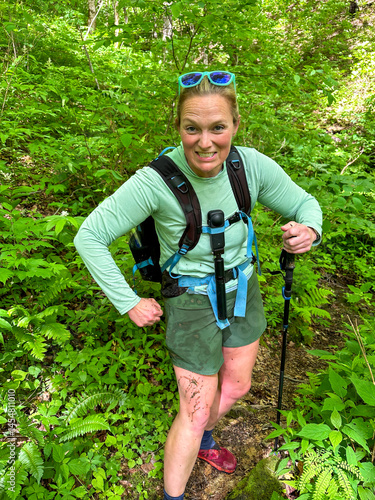 Woman Shows Off Muddy Leg After Fall into Creek