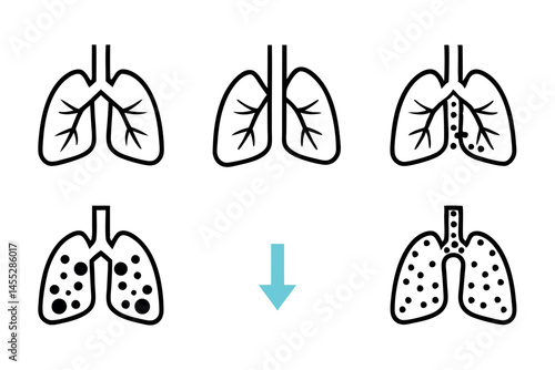 Medical vector icons depicting lung disease with viral infection, showing damage and pathogens in the respiratory system medical virus icon set