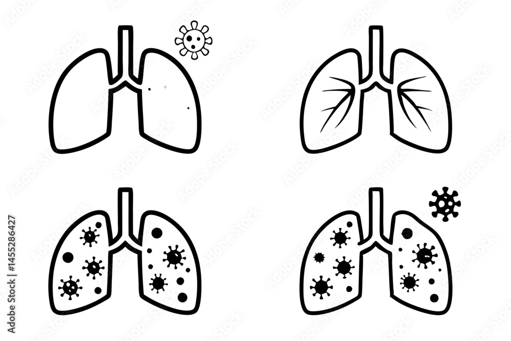 Fototapeta premium Medical vector depicting lung infection caused by a respiratory virus with visible inflammation and damage to lung tissues, medical virus icon set